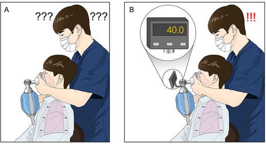 Determining the endpoint of air stacking. (A) There was concern that the peak pressure for the current method of air stacking could be inaccurate because it is dependent on the chest fullness experienced by the patient and the resistance felt in the hand of the assistant. (B) Visual assessment of digitally expressed peak pressure allows the practitioner to perform air stacking accurately and reduces anxiety regarding complications.