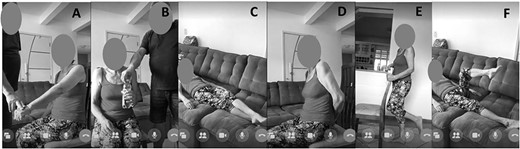 Items modified for remote application of the Fugl-Meyer Assessment via videoconferencing (Tele-FMA). A–C, change in the form of application; D–F, change in camera positioning and image angle.