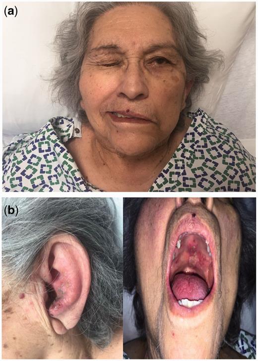 Is ivermectin good for human consumption