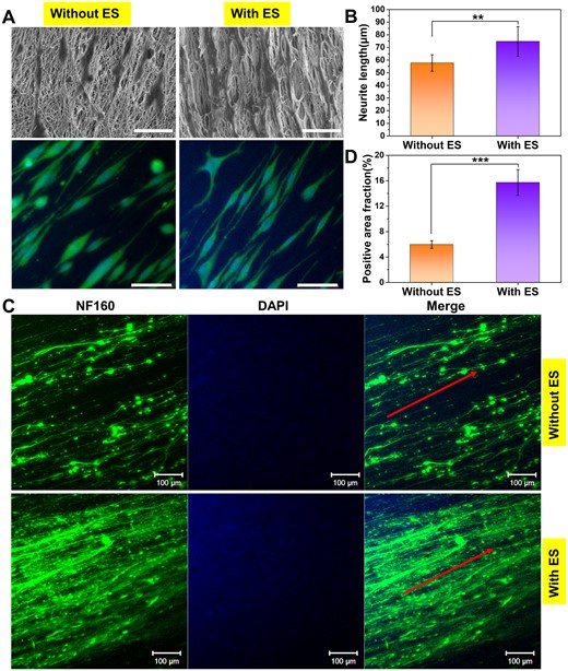 Neurite outgrowth of PC12 cells and DRG neurons on PC + LBP-NGF nanofibers under ES. (A) SEM images and immunofluorescent staining of PC12 cells after 7 days of differentiation under ES. The cytoskeletal protein was stained with α-tubulin (green), and the nuclei were stained with DAPI (blue) (scale bar: 50 μm). (B) Average neurite lengths of differentiated PC12 cells under different conditions. The analysis was performed by ImageJ software, and P values (**P < 0.01) are indicated on the chart. (C) Immunofluorescent staining of rat DRG neurons on PC + LBP-NGF nanofibers after 7 days of culture under ES. The green color indicates the expression of NF160, and the blue color indicates the nuclei. ES: Electrical stimulation (scale bar: 100 μm). (D) Positive area fractions of the DRG neuron immunofluorescence images. The analysis was performed using image J software, and P values (***P < 0.001) are indicated on the chart.