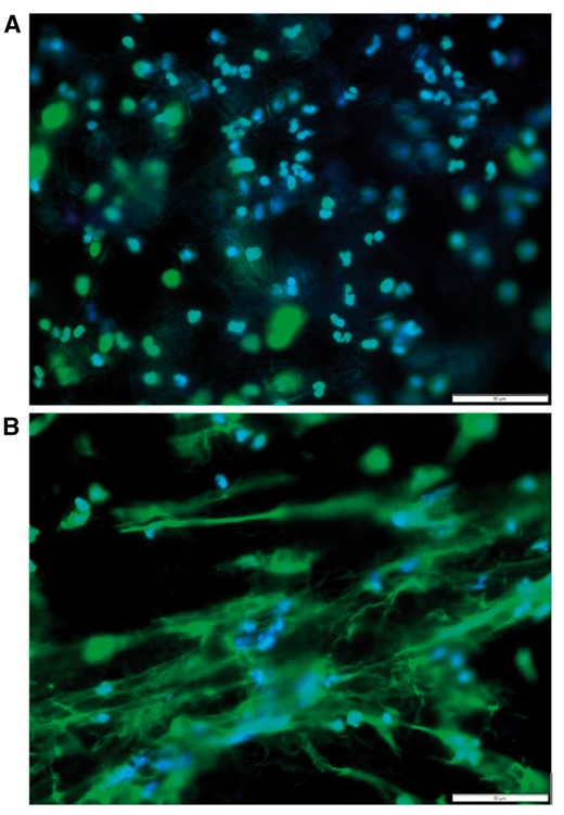  Representative fluorescent images of freshly isolated neutrophils seeded onto polydioxanone electrospun templates at 3 hrs. Top panel a is a large fiber diameter (1.9 ± 1 µm) template while bottom panel B shows a small fiber diameter (0.3 ± 0.1 µm) template eliciting a greater amount of NET extrusion. The stains utilized are DAPI (blue) for nuclei and SYTOX green (green) for extracellular chromatin, or NETs. For both images, magnification is 40× and scale bar is 50 µm.