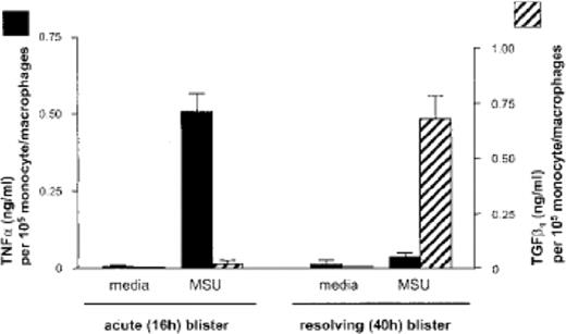 MSU crystal induction of TNF-α and TGF-β1 in human skin blister leucocytes. Cantharidin skin blisters were initiated by topical application of the vesicant cantharidin to the forearm of normal volunteers. Blister exudate cells were collected and pooled at the 16- and 40-h time points, corresponding to the acute and resolving phases respectively. Secretion of TNF-α and TGF-β1 were measured following culture for 24 h in the presence and absence of MSU crystals (0.5 mg/ml). Values show the mean and s.d. from three donors. Reproduced from Yagnik et al. [71] with permission from John Wiley & Sons, Inc. Arthritis & Rheumatism © Copyright 2004 the American College of Rheumatology.