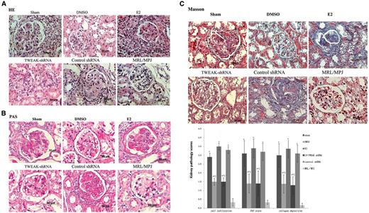 Histopathological changes in MRL/lpr mouse kidneys at day 29