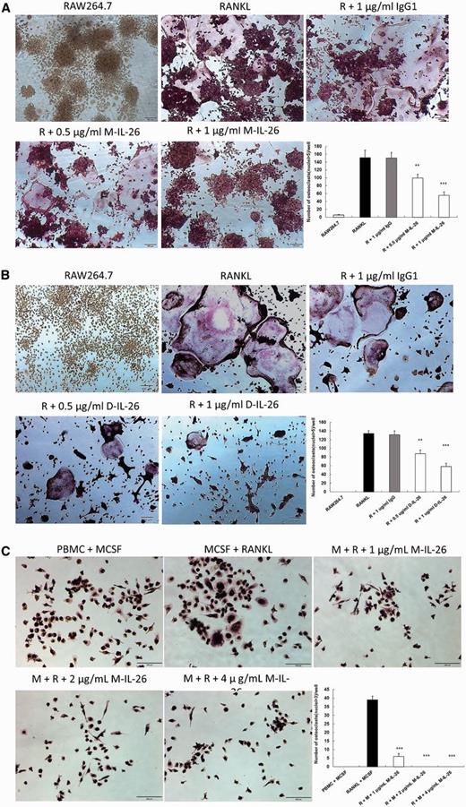 Effects of IL-26 on RANKL-induced osteoclast differentiation of RAW264.7 cells and PBMCs