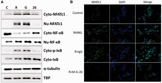 Effects of IL-26 on RANKL-induced nuclear translocation of NF-κB-p65 and NFATc1