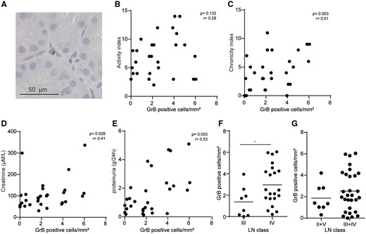 Local GrB in LN biopsies correlates with kidney damage