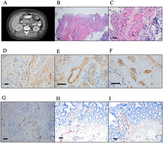 Radiographic and histology findings