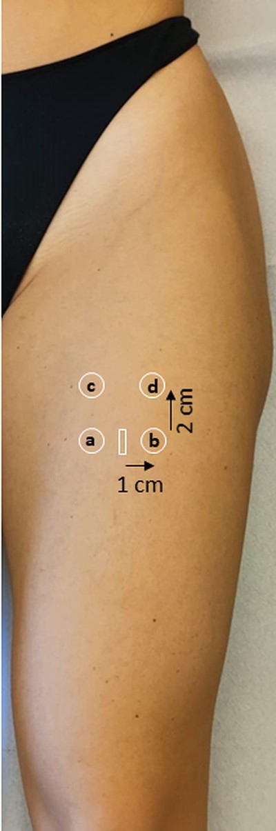 Scanning technique for the acquisition of shear-wave elastography images