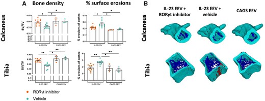 Treatment with RORγt inhibitor restores bone density and reduces bone surface erosions. µCT analysis of tibia and calcaneus bone at day 28 (IL-23 EEV n=10–11/group, CAGS EEV n=3/group). (A) Left: bone density (bone volume/total volume). Right: percentage surface erosions of cortex. All graphs show mean (s.e.m.), *P < 0.05, **P < 0.01, ***P < 0.001, ****P < 0.0001. (B) Representative 3D reconstructions of calcaneus and tibial bone with cortex in green, trabeculae in blue and bone surface erosions in red