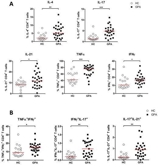 Higher percentage of intracellular cytokine production in circulating CD4+TH cells from patients with GPA. Peripheral blood from patients with GPA and HCs was stimulated with PMA and CaI and analysed with flow cytometry for intracellular IL-4, IL-17, IL-21, TNFα and IFNγ cytokine expression. (A) Percentages of IL-4+, IL-17+ IL-21+, TNFα+ and IFNγ+ CD4+TH cells from patient with GPA in remission (filled squares; n = 27) and HCs (open circles; n = 16). (B) Percentages of TNFα+IFNγ+, IFNγ+IL-17+ and IL-17+IL-21+ within CD4+TH cells from patient with GPA in remission (filled squares; n = 27) and HCs (open circles; n = 16). Horizontal bar represent median percentage. *P < 0.05, **P < 0.01, ***P < 0.001 vs HCs. CD4+TH: CD4+ T helper; CaI: calcium ionophore; GPA: granulomatosis with polyangiitis; HC: healthy control; PMA: phorbol myristate acetate