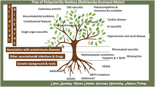 A schematic representation of aetiologic factors and clinical features of polyarteritis nodosa
