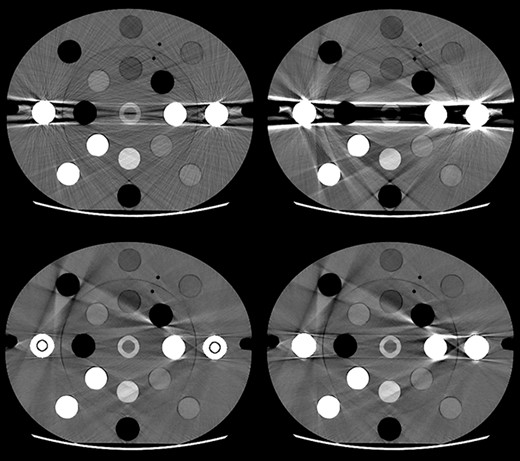 Visual examples of scans illustrating four 110 keV fast kV-switching DECT images of the electron density phantom with titanium (left) and steel (right) inserts. The upper images were reconstructed without metal artefact reduction (MAR), and the lower images with MAR. The images are displayed with a window level/width of 40/400 HU.
