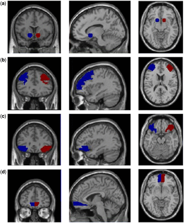 Key ROIs in the left and right hemispheres (blue and red clusters, respectively). Each row features a pair of homologous ROIs from coronal, sagittal and axial perspectives. (a) NAcc, (b) dlPFC, (c) lOFC, (d) mOFC.