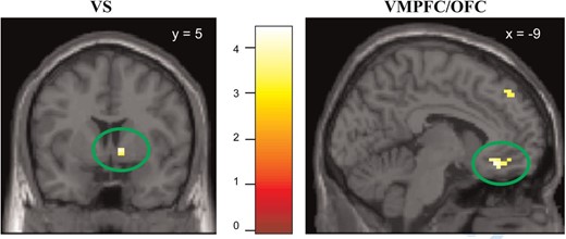 Brain activation in ROIs related to social sharing of emotions (contrast shared_emo > unshared_emo, masked with the interaction sharing × emotion), shown at P < 0.001, uncorrected. Left: Ventral striatum Right: Ventromedial prefrontal cortex/orbitofrontal cortex. Activations are significant at P < 0.05, FWE corrected within ROIs.