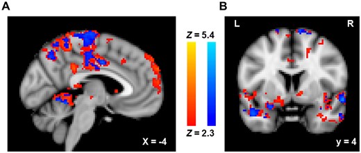 Whole-brain fMRI analysis for the retaliatory > non-retaliatory aggression contrast in which red voxels represent neural activity regressed onto retaliatory aggression scores and blue voxels represent overlap with the main effect of trial type. Clusters that are specific to the regression analysis are depicted in both a (A) sagittal view demonstrating an MPFC cluster and a (B) coronal view depicting a cluster in the left NAcc.