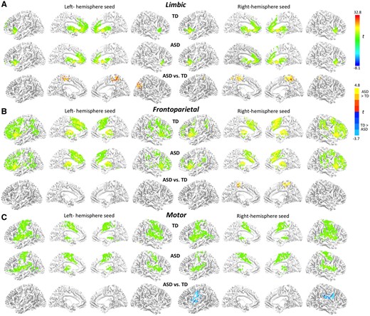 Surface renderings of within-group and between-group functional connectivity effects for three striatal seeds per hemisphere in (A) limbic, (B) frontoparietal and (C) motor parcels (as shown in Supplementary Figure S1A; all clusters).