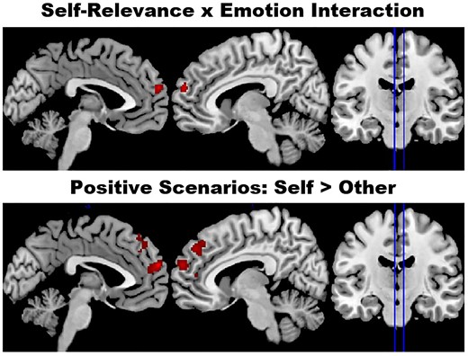Activations in the mPFC ROI. A Self-Relevance x Emotion interaction was observed in the mPFC small volume correction analysis. Follow-ups showed effects of Self-Relevance for positive scenarios, but not neutral or negative scenarios. Voxels showing greater activity for self than other are highlighted in red (no regions showed the opposite effect). Effects are shown at a voxel-level significance threshold of P < 0.001 for regions where the peak reached a FWE-corrected threshold of P < 0.05. See Table 2 for the full list of peaks.