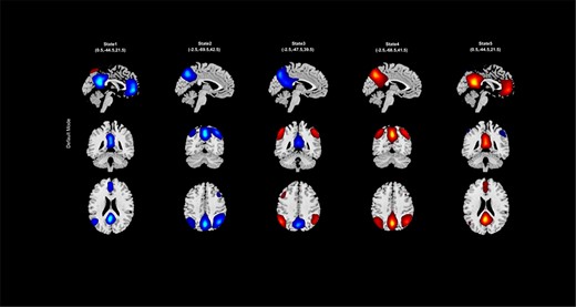 An example of spatial states for the default mode.