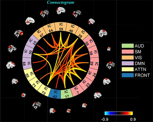 One of the clusters represented as a connectogram.