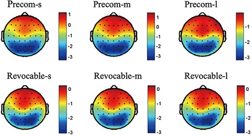 The topographic distribution of the average N1 amplitudes (120–200 ms) for the interaction between task types and delay time.