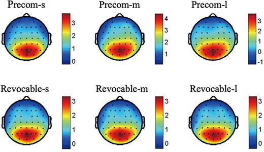 The topographic distribution of the average P300 amplitudes (320–400 ms) for the interaction between task types and delay time.