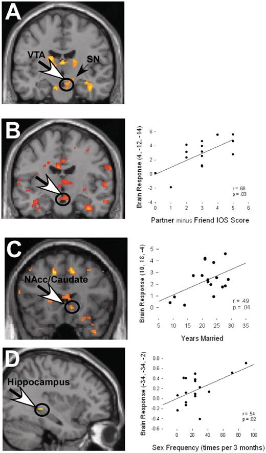 (A) Individuals self-reporting intense love for a long-term spouse show significant neural activation in dopamine-rich, reward regions of the VTA/SN in response to images of their partner vs a highly familiar acquaintance (HFN). (B) Image and scatter plot illustrating the association between brain response in the VTA and Partner minus close friend (CF), Inclusion of Other in the Self (IOS) scores. Greater closeness with the Partner was associated with greater response in the VTA for the Partner vs a CF. (C) Image and scatter plot illustrating the association between brain response in the NAcc/Caudate and number of years married to the partner. Greater years married was associated with stronger response in the NAcc/Caudate for the Partner (vs a CF). (D) Image and scatter plot illustrating greater response to the Partner (vs HFN) in the region of the posterior hippocampus is associated with higher sexual frequency.