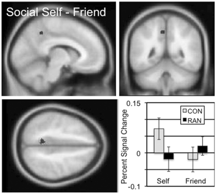 The two-sample comparison of the CON and RAN groups in the social self–friend contrast (‘I am’) identified a cluster in the precuneus with a peak t of 4.61 consisting of 43 voxels. Slices centered on MNI coordinates of the peak voxel (−8, −48, 46). The percent signal change in this cluster for the self and friend conditions is shown for the CON and RAN groups in the lower right panel.