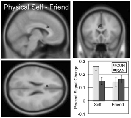 The two-sample comparison of the CON and RAN groups in the physical self–friend contrast (‘I look’) identified a cluster in the ventral anterior cingulate with a peak t of 4.50 consisting of 61 voxels. Slices centered on MNI coordinates of the peak voxel (−6, 20, 24). The percent signal change in this cluster for the self and friend conditions is shown for the CON and RAN groups in the lower right panel.