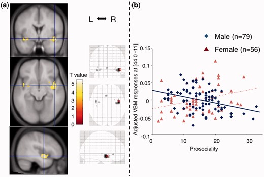Male-specific correlation between ‘prosociality’ and GMV in the right insula. (a) The grey matter regions where an interaction between sex and ‘prosociality’ was found are rendered in the MNI space (n = 135) (voxel threshold: uncorrected P < 0.001), L, left; R, right. (b) Scatter plots depicting correlations between regional GMV in the right insula and ‘prosociality’, in which higher score indicates stronger ALTs, in males and females.