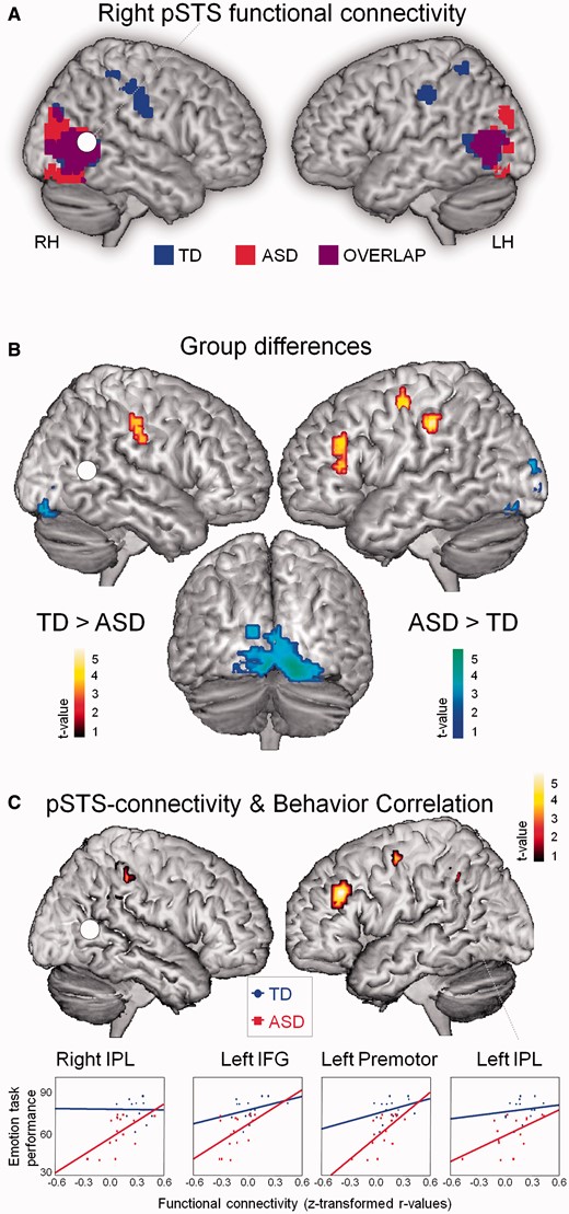 Resting-state iFC. (A) Resting-state iFC pattern of right pSTS in ASD and TD groups (one-sample t-test, P < 0.05, cluster-wise corrected). (B) Between-group comparisons showed that pSTS-iFC with bilateral IPL, left premotor and IFG was stronger in the TD group than in the ASD group (two-sample t-test, P < 0.05, cluster-wise corrected) (red–yellow). Stronger pSTS-iFC in the ASD group was observed with lingual/calcarine gyrus and superior occipital gyrus (blue–green). (C) Emotion recognition ability was positively correlated with the strength of pSTS-iFC with left/right IPL, left IFG, premotor area and left SMA (not shown) (P < 0.05, cluster-wise corrected).