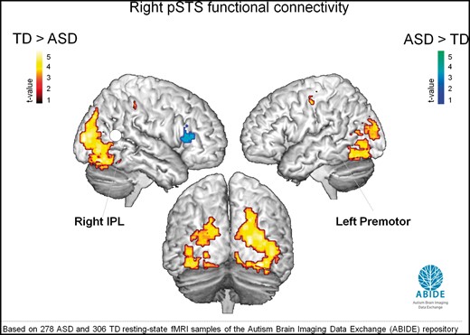 ABIDE: resting-state iFC. Brain regions showing differences in resting-state iFC with right pSTS between the TD group (n = 306) and ASD group (n = 278) of the ABIDE sample (ABIDE) (two-sample t-test, P < 0.05, cluster-wise corrected). Stronger pSTS-iFC was observed in the TD group with right IPL, left premotor, bilateral fusiform gyrus and bilateral SOG (red–yellow) (regions indicated in bold font were previously identified in the original sample of 30 participants). Stronger pSTS-iFC in the ASD group was observed with right IFG (part triangularis) (blue–green) and left thalamus (not shown).