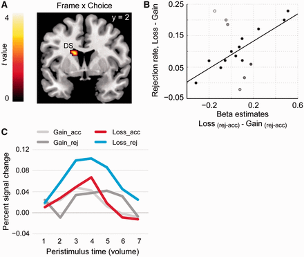 Neural effects of interaction between choice and frame. (A) ROI-based analysis of the contrast ‘Loss (rej-acc) − Gain (rej-acc)’. SVC revealed an activation cluster in the left DS, whose rejection-induced activation was higher in the loss compared with gain domain. (B) Activation timecourse extracted from a 6 mm sphere around the maximum coordinates indicates that this interaction effect was driven by the amplified activation difference in the loss relative to the gain domain. (C) The differences in beta estimates extracted from the activation maximum (Loss − Gain) predicted the increases in rejection rate in the loss relative to the gain domain (r = 0.67, P < 0.05). Note, the white and grey dots are outliers identified by robust regression and they are down-weighted in computing the correlation coefficients (Wager et al., 2005).