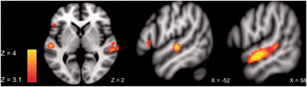 ROI activity for emotional > neutral prosody across tasks at the threshold Puncorr < 0.001.