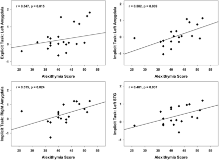 Alexithymia correlations with ROI activity for angry prosody directly contrasted to neutral prosody. Top panel: Positive correlation of alexithymia with activity of the left amygdala in the explicit (left) and the implicit task (right). Bottom panel: Positive correlations of alexithymia with activity of the right amygdala (left) and the left STG (right) in the implicit task.