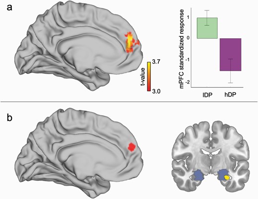 Group difference in brain activations related to extinction effects. (a) There was a significant interaction between the groups during extinction phase in medial prefrontal cortex (mPFC) in that the activation associated with extinction learning was larger for lDP than for hDP. (b) The PPI-analysis suggested that there was a significant difference in the connectivity between mPFC and amygdala between lDP than in hDP. Red area in (b) represents the seed region in mPFC. Blue area represents amygdala ROI. Yellow color indicates the significant connectivity result.