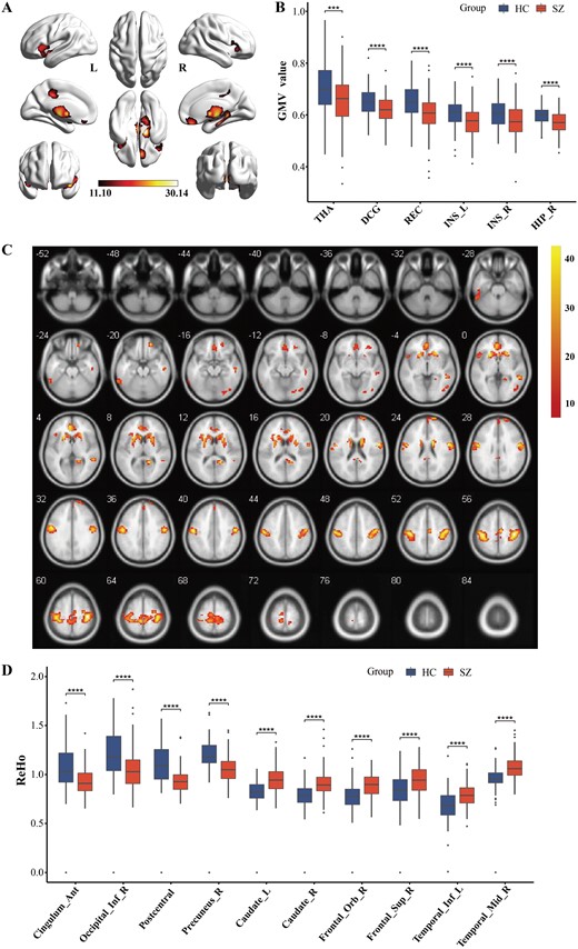 Brain structural and functional changes in SZ patients. (A and B) The whole-brain VBM analysis and post-hoc intergroup comparisons (P < .001, FEW corrected). (C and D) The whole-brain ReHo analysis and post-hoc intergroup comparisons (P < .001, FEW corrected). *P < .05, **P < .01, ***P < .001, ****P < .0001. L, left; R, right; THA, thalamus; DCG, middle cingulate gyrus; REC, gyrus rectus; INS, insula; HIP, hippocampus; caudate, caudate nucleus; frontal_Orb, orbital frontal gyrus; frontal_Sup, superior frontal gyrus; temporal_Inf, inferior temporal gyrus; temporal_Mid, middle temporal gyrus; cingulum_Ant, anterior cingulate gyrus; occipital_Inf, inferior occipital gyrus.