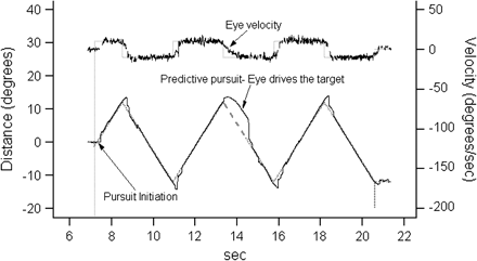 Smooth pursuit eye movements are broadly divided into 2 components: (1) response to the processing of image motion on the retina and (2) the predictive response based on the internal representation of the target motion (ie, memory trace of the previous image motion on the retina and copy of the motor command driving the eye called efference copy). The first component is measured at the time of pursuit initiation when the target image starts moving away from the fovea. The figure illustrates one method of measuring predictive pursuit. In this gaze contingent task, the trial begins with the computer driving the target on the monitor back and forth horizontally and subject's eye following the target (bottom panel; left axis shows the distance traveled in degrees of visual angle from left 15 degrees [−15 degrees] to right 15 degrees and back). During one of the times when the target is changing direction, unbeknownst to the subject the software switches the control such that that now the eye drives the target (for details, see Hong et al.120). Because this happens at the time of change of direction, now the eye based on the internal representation of the target behavior initiates pursuit in the expected direction of the target motion (shown by thick dashed lines in the bottom panel). As can be seen, this subject shows good predictive pursuit with the eye velocity being slightly less than the expected target velocity (slope of the eye trajectory in the bottom panel or the velocity tracing in the top panel shows the magnitude of the eye velocity). Predictive pursuit is abnormal in schizophrenia, highly heritable, and associated with functional variation COMT gene.22,32