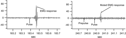 The figure shows examples of recording of the orbicularis oculi electromyographic (EMG) activity in response to pulse alone (left panel) and prepulse-pulse stimulus (right panel). In this experiment, subjects were acclimatized to a 3-min period with 70-dB white noise; startling pulse stimulus was 116 dB white noise lasting 40 ms, and the prepulse was a 20-ms, 80 dB white noise. The EMG recording was processed offline with a 100-Hz high pass filter and baseline correction using 100 ms prestimulus baseline. Response onset was defined by the first crossing from the baseline activity within a 20–120 ms window after stimulus onset. Peak response amplitude was calculated by the difference of the most positive peak and most negative trough in a 20–150 ms window after pulse onset.