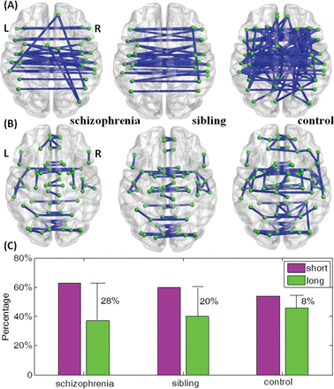 We wish to print this figure with color reproduction too. The top 10% of significant long links from 1-sample t tests within each group are displayed in panel (A). There are 29 long links within schizophrenia group, 31 long links within sibling group, and 76 long links within controls. The top 10% of significant short links within each group are displayed in panel (B). There are 49 short links within schizophrenia group, 47 short links within sibling group and 92 short links within controls. (C) Bar plot of the proportional difference of short links and long links within each group displaying the difference between P-short and P-long shown in Supplementary Data.