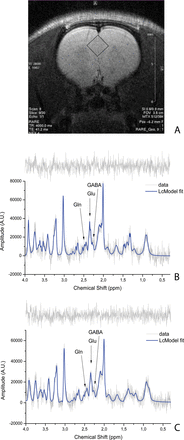 Voxel localization on rat anterior cingulate cortex (ACC) (A). Example of a correspondent baseline spectrum for isolated rat with time effect (TE) = 8ms, NSA = 128 (B). Example of a correspondent spectrum at time point KET9 with TE = 8ms, number of signal averages = 128 (C). On the top of each spectrum, the spectrum residue is shown.