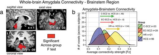 Brainstem region functional connectivity for high-risk subjects (HR) vs age- and demographically matched healthy comparison subjects (HCS). Given the somewhat unexpected amygdala-brainstem connectivity finding, driven by the HR group, we compared connectivity patterns for the identified brainstem region between HR subjects and a subset of age- and demographically matched HCS. This was especially important given concerns that this finding may be related to brain maturation (rather than a risk factor for developing schizophrenia or psychiatric illness more broadly). This follow-up analysis was also important to better understand other possible circuits involved in elevated amygdala-brainstem connectivity patterns found for the HR group. Therefore, we identified a subset of HCS matched to the HR group across all demographic variables, but most importantly age (mean = 19.95, SD = 4.58). (a and b) We computed an independent samples t-test between the HR group and the age-matched HCS using the identified brainstem region as a seed. Type I error corrected results revealed elevated amygdala connectivity in the HR group, given that this is a partially circular analysis (red arrows). However, the analysis also revealed reduced connectivity between the brainstem region and frontoparietal cortical regions for HR subjects relative to age-matched HCS. This analysis is partially circular and should be interpreted as qualitative to better understand the source of the amygdala-brainstem connectivity alterations in the HR group. That is, we identified the brainstem region with the between-group F-test (figure 2), which we used here to compare HR subjects relative to a specific subgroup of age-matched controls. Independence concerns notwithstanding, this post hoc analysis revealed prefrontal clusters that may contribute to altered amygdala-brainstem coupling pattern identified for the HR group. Perhaps most importantly, this age-matched follow-up analysis provides a further validity check, showing that age alone did not drive the reported amygdala-brainstem effects in the HR group.