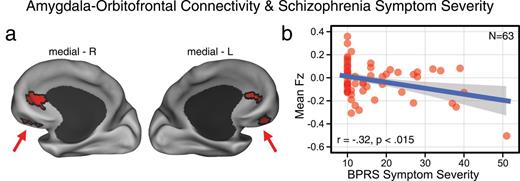 Schizophrenia is associated with reductions in amygdala-orbitofrontal connectivity. (a) Red foci mark the regions surviving the whole-brain 1-way ANOVA F-test. Both chronic (C-SCZ) and early-course (EC-SCZ) schizophrenia groups showed significantly decreased amygdala connectivity relative to healthy comparison subjects (HCS), whereas high-risk (HR) individuals showed no significant alterations. This pattern was centered on the bilateral medial orbitofrontal cortex (OFC) (left OFC: x = −17, y = 35, z = −2; right OFC: x = 18, y = 34, z = −1). (b) Effect sizes (Cohen’s d) verify robust amygdala-OFC connectivity reductions for C-SCZ (green histogram) and EC-SCZ (red histogram) groups, whereas the HR (yellow histogram) did not exhibit changes relative to HCS (yellow histogram completely beneath the blue histogram). Blue vertical dashed line marks the mean for the HCS group. Note: the voxel counts on the y-axis reflect the mean voxel number for each group at a given connectivity strength within the identified region.