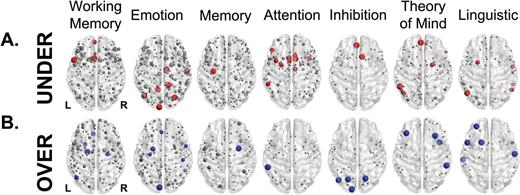 Anatomical location of under- and over-activations in schizophrenia elicited by different tasks. Regions sized according to the probability of finding an under-activation ( A ) or an over-activation ( B ) in the most frequently reported tasks. Nodes in red/blue represent locations where differential activations were statistically more frequent than the null model ( P < .01, uncorrected), and grey nodes where they did not reach statistical significance. Across different tasks, there was no consistency in the anatomical distribution of differential activation.