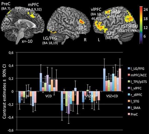 Foci and contrast estimates of brain regions, that distinguished between groups on Theory of Mind related brain activationa. aP < .05 corrected for multiple comparisons after Family-Wise-Error at cluster-level. Significant clusters of activation differences include the medial PFC (Brodman areas [BAs] 8,9,32; MNI: −10, 28, 40; k = 407; z = 4.26), left ventrolateral PFC (BAs 10,46,47; MNI: −44, 50, 6; k = 1095; z = 4.78), extending into the left superior temporal gyrus (STG, BA 38; MNI = −46, 14, −20; z = 4.52), left supplementary motor area (SMA, BA 6; MNI: −24, 12, 60; k = 413; z = 4.25), right dorsolateral PFC (BA 46; MNI: 48, 32, 24; k = 705; z = 4.64), left pSTS/TPJ (BA 39,40; MNI: −26, −66, 44; k = 1330; z = 4.69), the bilateral precuneus (BA 7, MNI: −2, −72, 56; k = 557; z = 4.63) and lingual/fusiform gyrus (BAs 18,19; MNI: 24, −84, −20; k = 812; z = 5.09). The color or b/w bar indicates F-value.