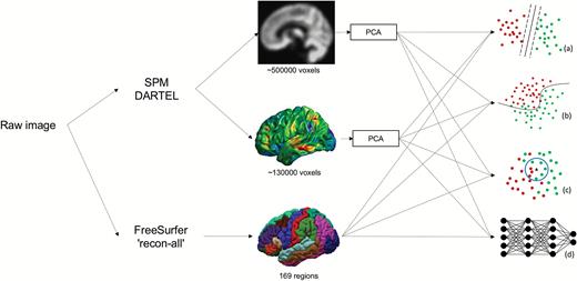 Three features were extracted from each image: GMV, VBCT, and FreeSurfer surface-based regional volumes and cortical thickness. The dimensionality of GMV and VBCT was reduced through PCA. The resulting features were analyzed with four classifiers: (a) SVM, (b) LR, (c) KNN and (d) DNN. GMV, gray matter volume; VBCT, voxel-based cortical thickness; PCA, principal component analysis; SVM, support vector machine; KNN, k-nearest neighbors; LR, logistic regression; DNN, deep neural network.