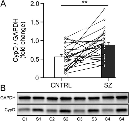 CypD protein levels are elevated in the DLPFC of patients with schizophrenia. (A) Hybrid bar graph and scatter plot showing that in 21/26 matched pairs (including one triad, indicated by dashed connector lines) patients with schizophrenia (SZ) showed significantly higher GAPDH-normalized CypD protein levels than unaffected comparison subjects (CNTRL). Error bars = SEM, P < .01. (B) Lanes from a representative western blot loaded with tissue from 4 matched comparison (C1-4) and schizophrenia (S1-4) subject pairs. CypD, cyclophilin D; DLPFC, dorsolateral prefrontal cortex; GAPDH, glyceraldehyde-3-phosphate dehydrogenase.