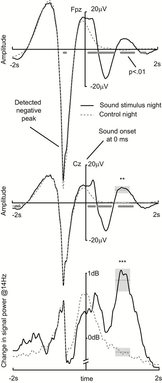 Electroencephalography (EEG) results. Upper two curves show the group average of the EEG response in Fpz and Cz channels time locked to the negative peak of spontaneous slow wave. An automatic online algorithm was using the channel Fpz to detect slow waves and the channel Cz was used in group level offline statistics. Below the curves the time points of significant difference between conditions are shown based on paired samples t-test with noncorrected alpha level of 0.01. During the stimulus night the sound stimulus was presented at 600 ms after the slow-wave peak (time zero in this image), whereas during the control night the sound stimulus was missing. Lowest curve shows change in the 14 Hz oscillatory power from baseline (from −2 seconds to zero) in decibels. The grey boxes show the time window (width), mean (horizontal line in the middle), and its standard error (height of the box) of values extracted from the curves for statistical analyses. **p < .01, ***p < .001.