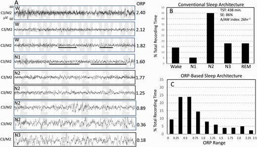 Records from one subject from the Sleep Heart Health Study. (A) Nine 30-second EEG tracings representing EEG patterns receiving ORP values spanning the entire ORP range (0.00–2.50). Epochs with ORP > 1.75 are typically scored wake but exhibit a wide spectrum from full wakefulness with high ORP (top panel) to patterns with sleep features (theta activity and micro-sleep) but do not meet the criteria of sleep. Likewise, a wide range of patterns can be identified in epochs typically scored NREM sleep. The figure shows ORP values ranging 0.36–1.77 within stage N2. (B) Conventional sleep stages in the same subject showing normal values. (C) The proposed ORP-based architecture in which % of epochs occurring within each ORP decile is illustrated. Deciles 1 and 2 represent very deep and deep sleep, respectively (cf. A, two bottom epochs). Decile 3 is moderate sleep and decile 4 is light sleep. Deciles 5–7 are transitional states with progressively increasing wake features (alpha-beta rhythms). Deciles 8 and 9 represent epochs typically scored wake but with sleep features. Decile 10 is seen in full wakefulness (A, top panel).