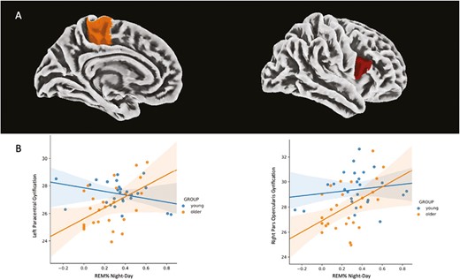 (A) Association between REM%Night–Day and cortical gyrification. Cortical parcellation was obtained with the Desikan Kiliany atlas and results are overlayed on an MNI template. (B) Linear regression lines and 95% confidence intervals of the association between REM%Night–Day and cortical gyrification according to the age group (left paracentral lobule: pFDRcorr = .002, R-squared = 0.541; right pars opercularis: pFDRcorr = .010, R-squared = 0.424).