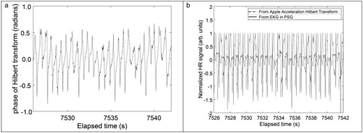 (A) Phase of Hilbert transformed jerk signal (B) Normalized phase of Hilbert transformed jerk signal and polysomnography electrocardiogram signal with slow motion artifacts removed using a time-domain high-pass filter with a 0.8 seconds window.